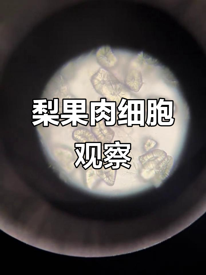 梨子石细胞结构揭秘:厚壁组织与纹孔道解析
