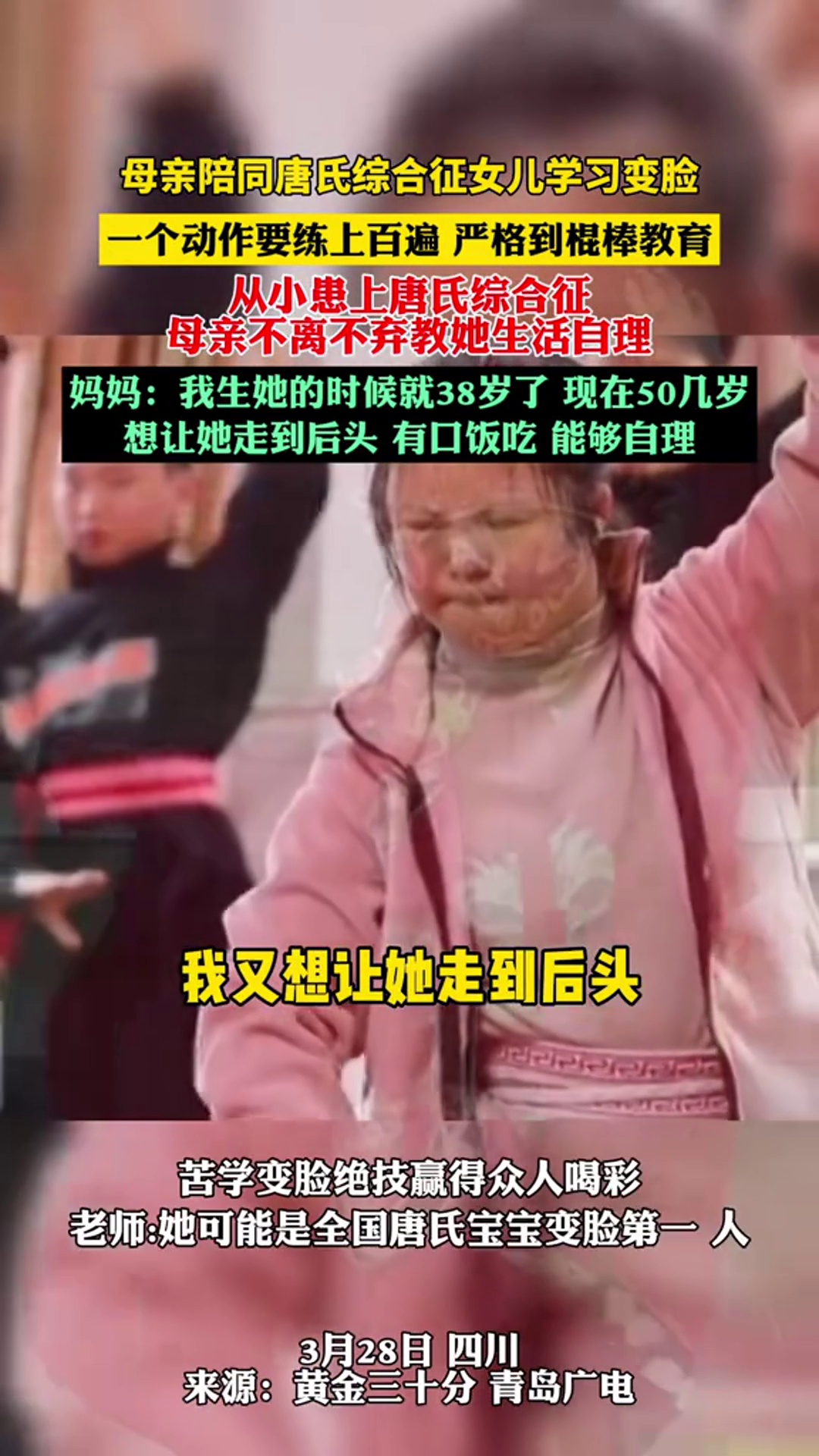 母亲陪同唐氏综合征女儿学习变脸,一个动作要练上百遍严格到棍棒教育。从小患上唐氏综合征,母亲