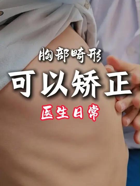 孩子鸡胸,胸骨和肋骨高了,目前孩子较小,没有出现心肺功能受损的表现,但还是应该早发现早治疗