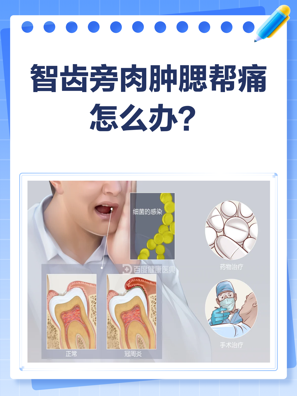 智齿旁肉肿腮帮痛？快来看看怎么回事！