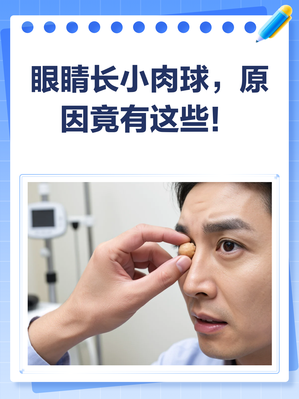 眼睛长小肉球？别急，先了解这些可能原因！