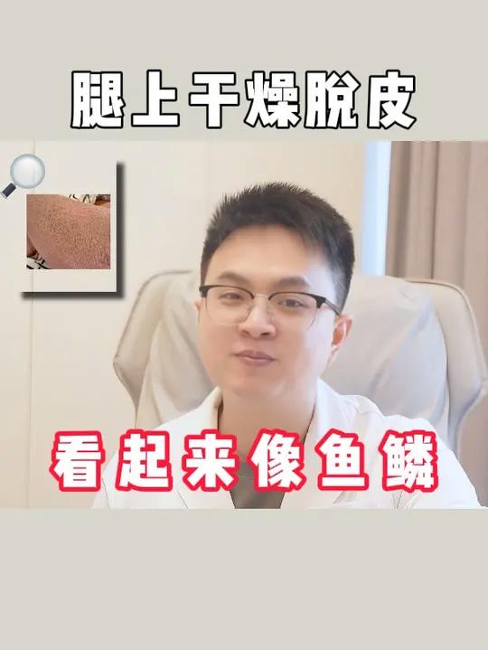 腿上干燥脱皮看起来像鱼鳞,其实是种病