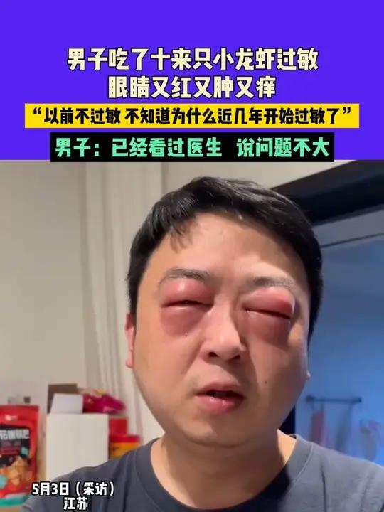 5月3日(采访)江苏,男子吃了十来只小龙虾过敏,眼睛又红又肿又痒,“以前不过敏 不知道为什
