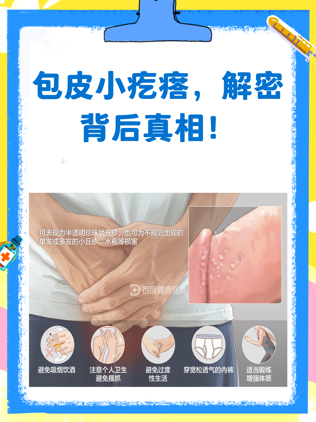 包皮小疙瘩密布,别慌,先看这篇!