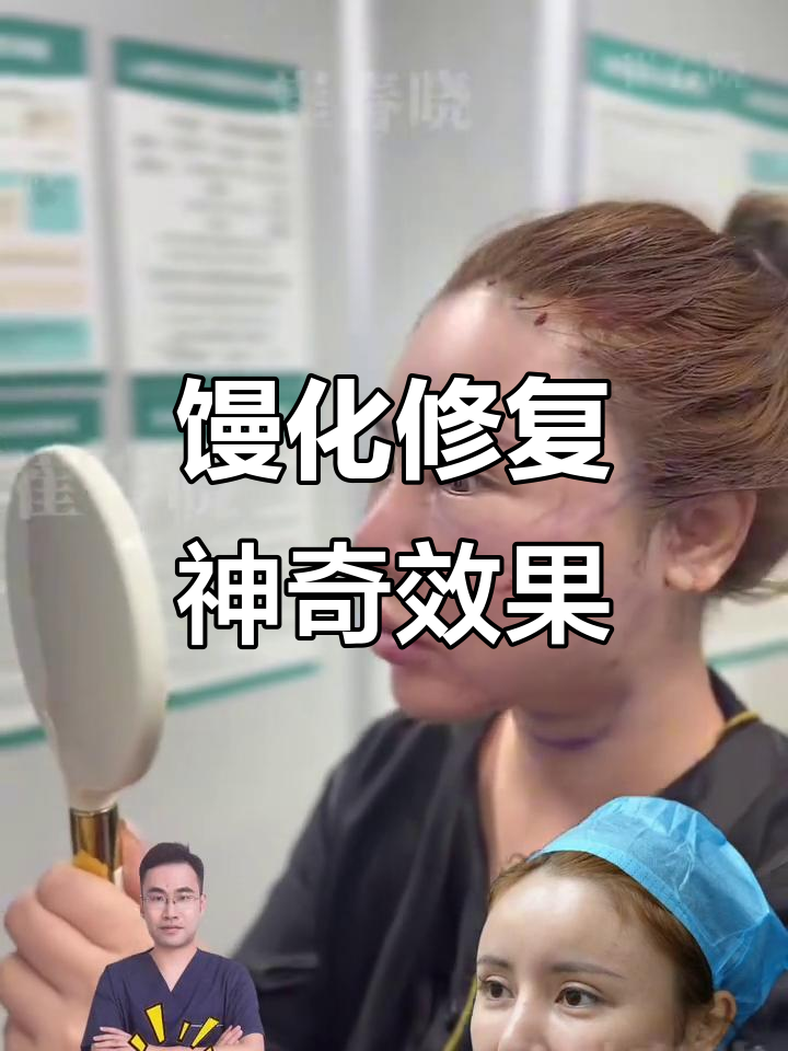 房主大变身,馒头修复中心效果惊艳!