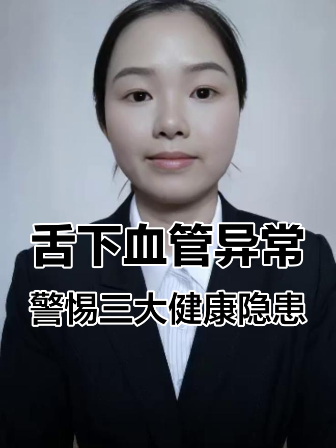 舌下血管发紫变粗?可能是这3个问题在作怪
