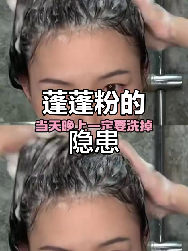 蓬蓬粉用多了伤毛囊,油头妹子必看!