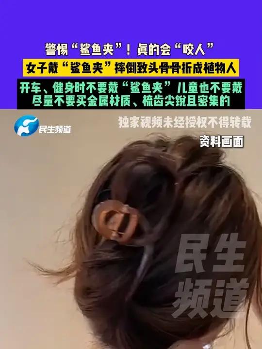 6月17日(发布)警惕“鲨鱼夹”!真的会“咬人”,女子戴“鲨鱼夹”摔倒致头骨骨折成植物人,
