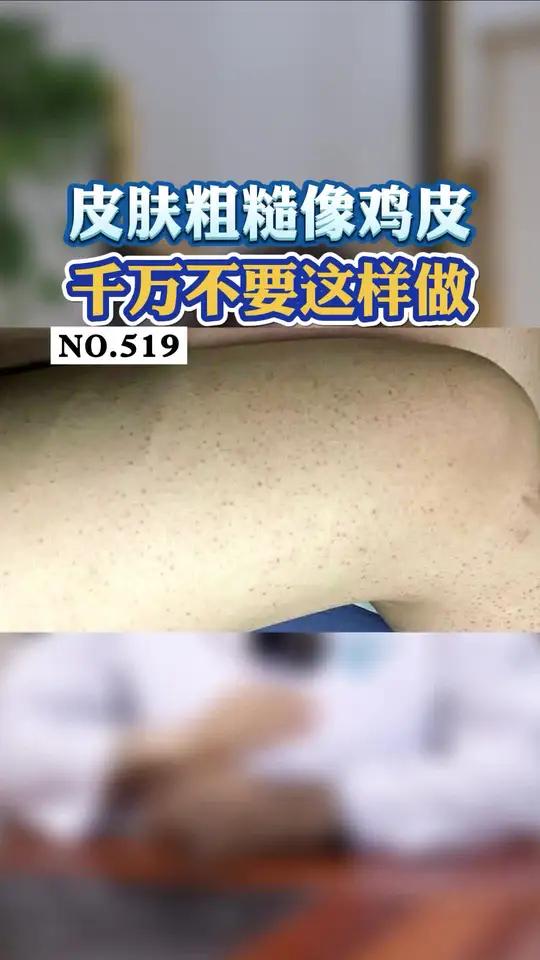 手臂、大腿皮肤粗糙,像鸡皮一样,短袖短裤都不敢穿,这样处理很简单