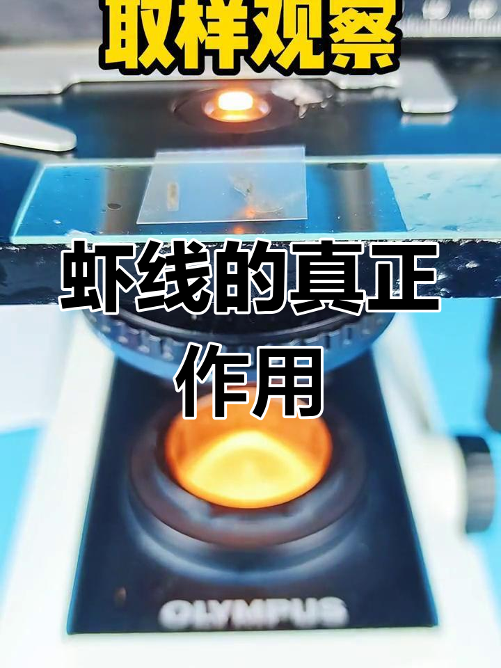 虾线到底是哪个器官?揭秘真相