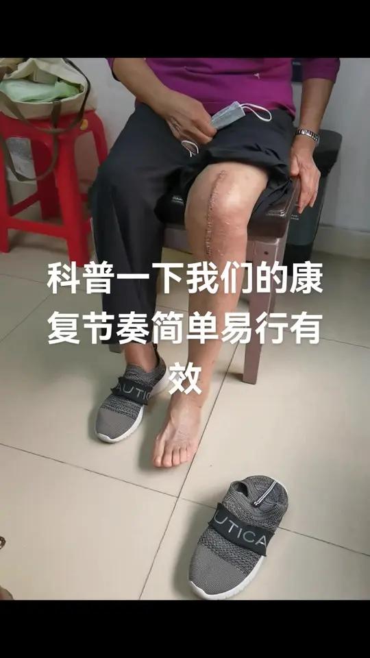 这是一个术后2周的全膝关节置换术患者,还没有拆除皮肤钉。这里是展示一下我们的康复的技巧。希