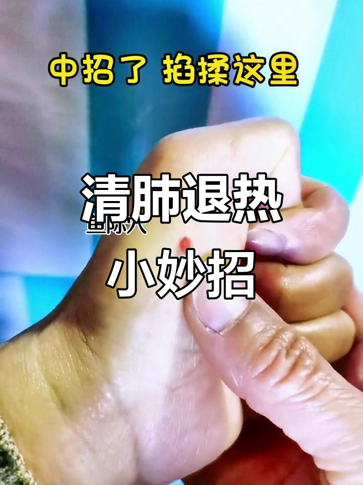 鱼脊穴清肺热，退烧效果立竿见影