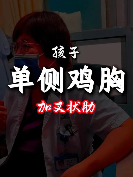 女孩膨出性叉状肋,合并单侧鸡胸,会随着年龄逐渐的长