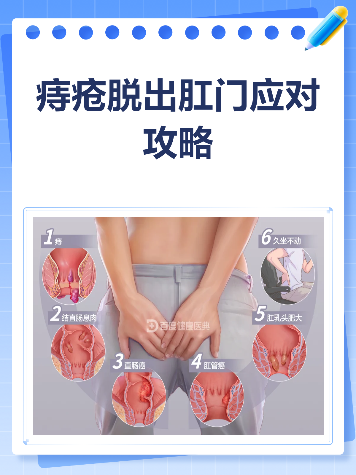 痔疮脱出肛门?别急,应对攻略来啦!