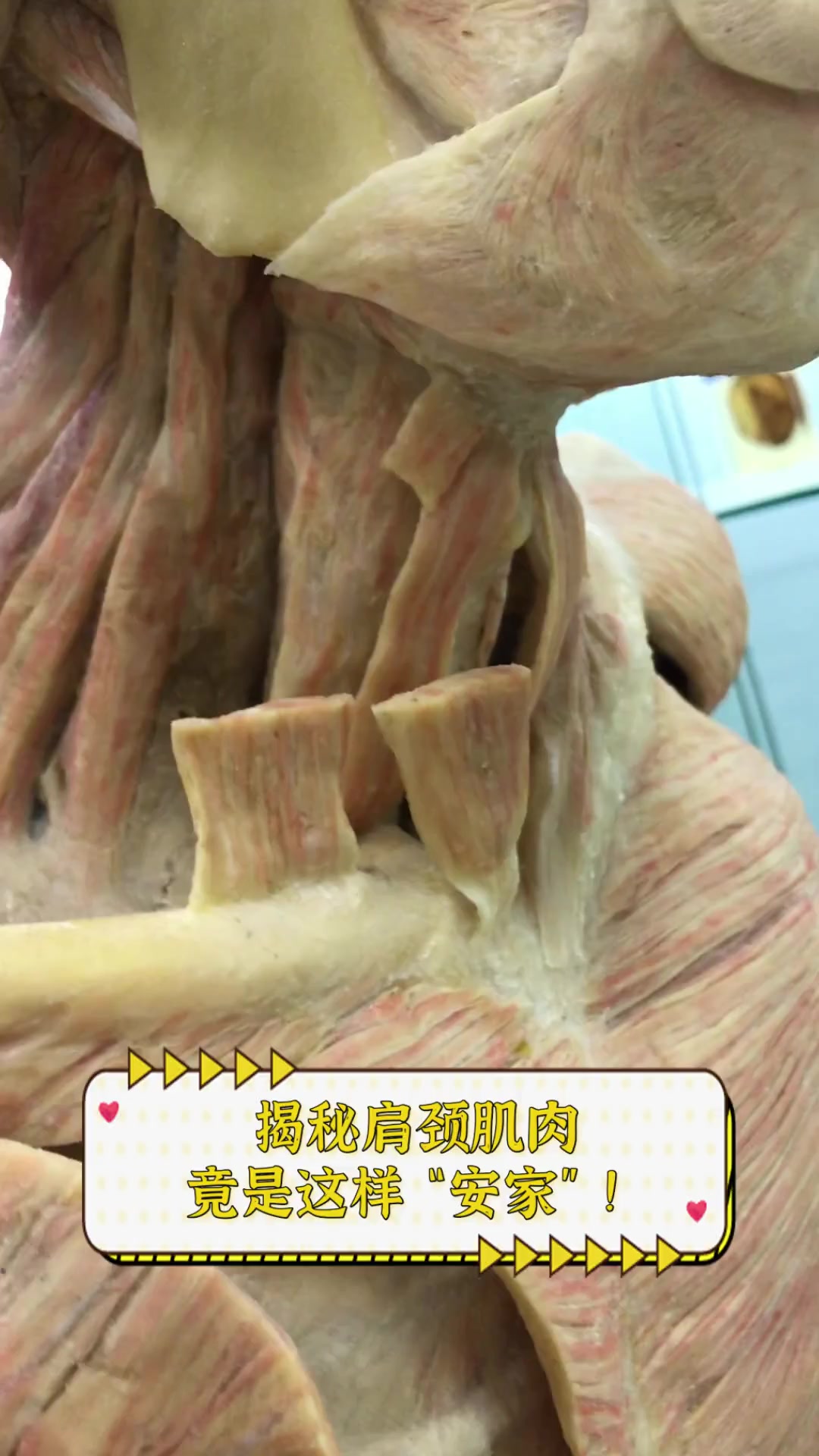 揭秘肩颈肌肉,竟是这样“安家”!