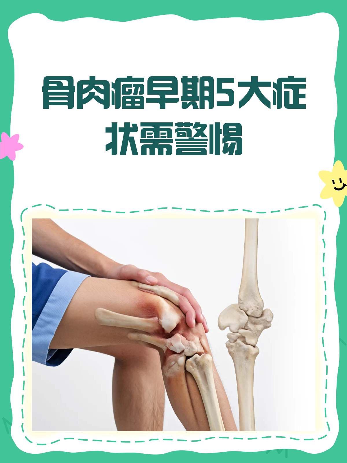 骨肉瘤早期,这些信号你收到了吗?