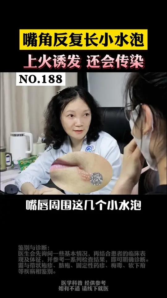 嘴巴嘴角长疱疹,教你怎么快速消除,减少复发