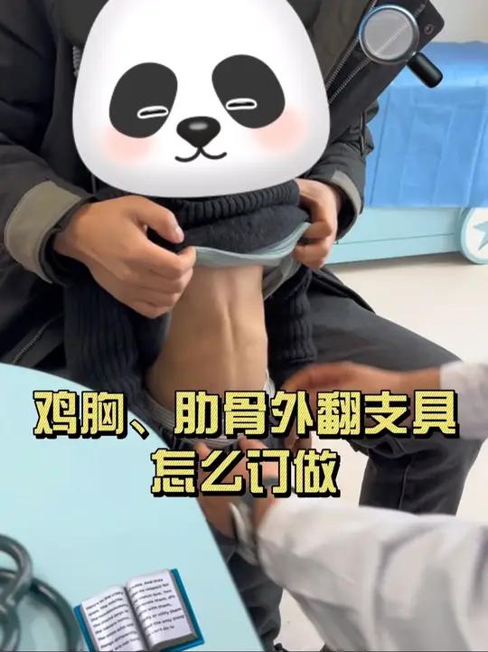 鸡胸 肋骨外翻支具怎么订做