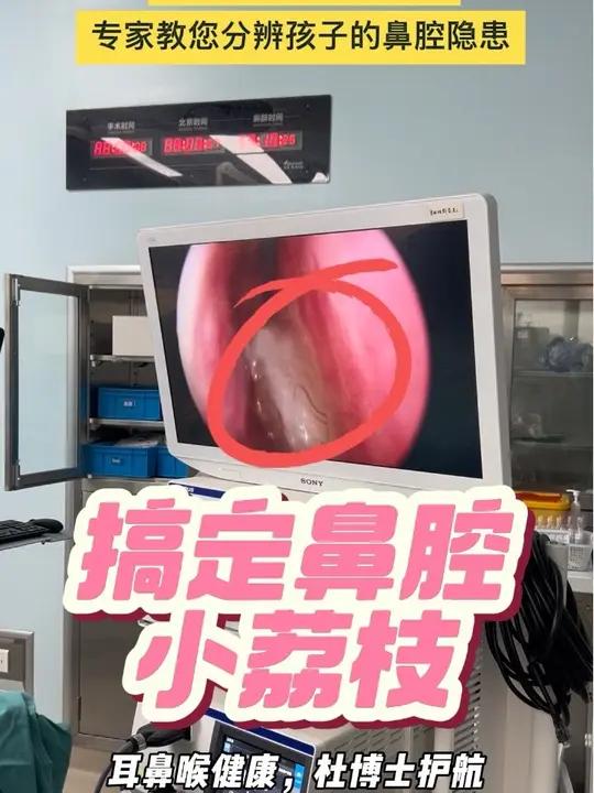 别把鼻息肉当荔枝!专家教您分辨孩子的鼻腔隐患