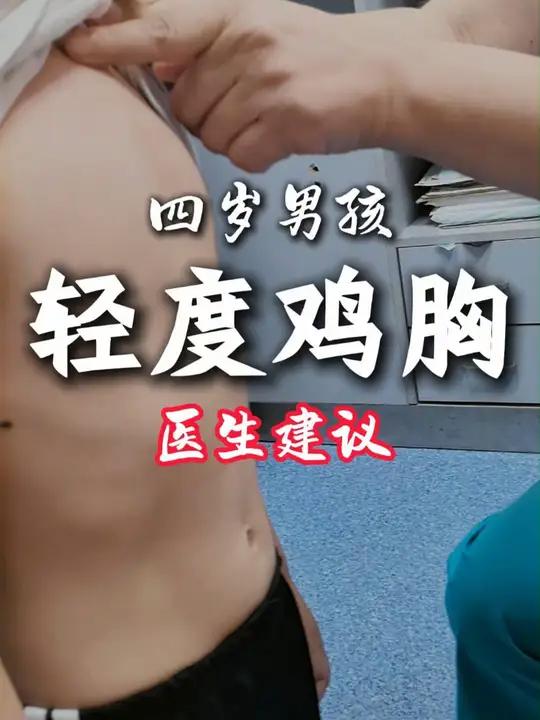 男孩轻度鸡胸,剑突有些凹陷,一方面多加锻炼,另外一个注意补钙补维生素D的问题