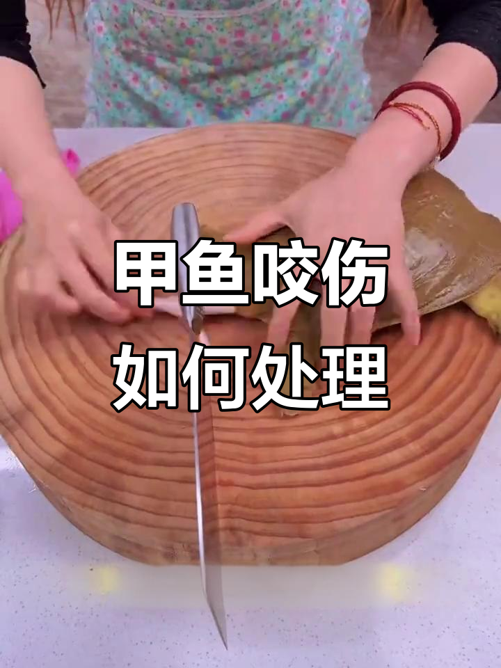 被甲鱼咬了怎么办?教你正确应对方法
