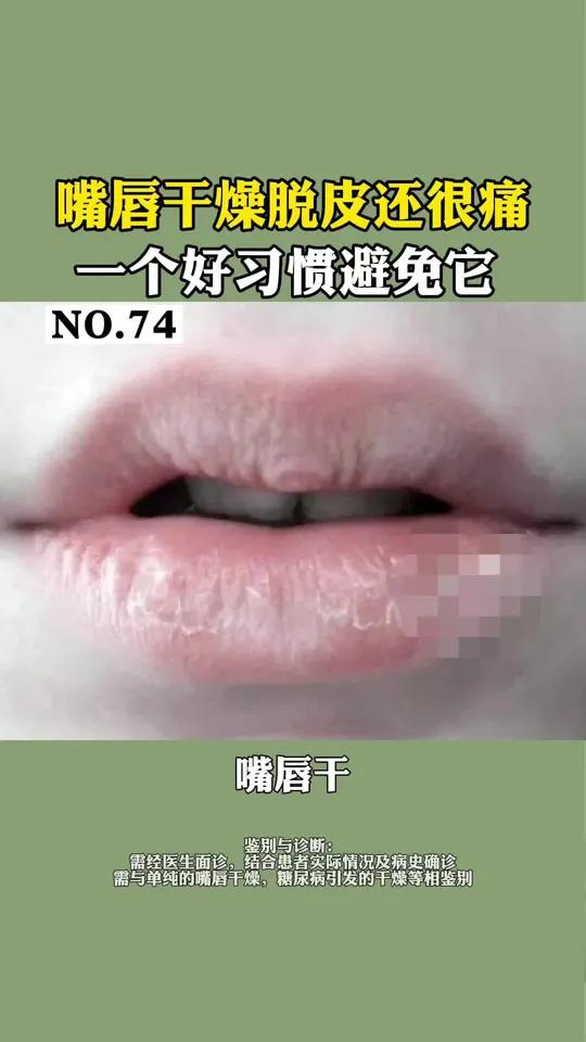 口红用不对,皮肤病找上你