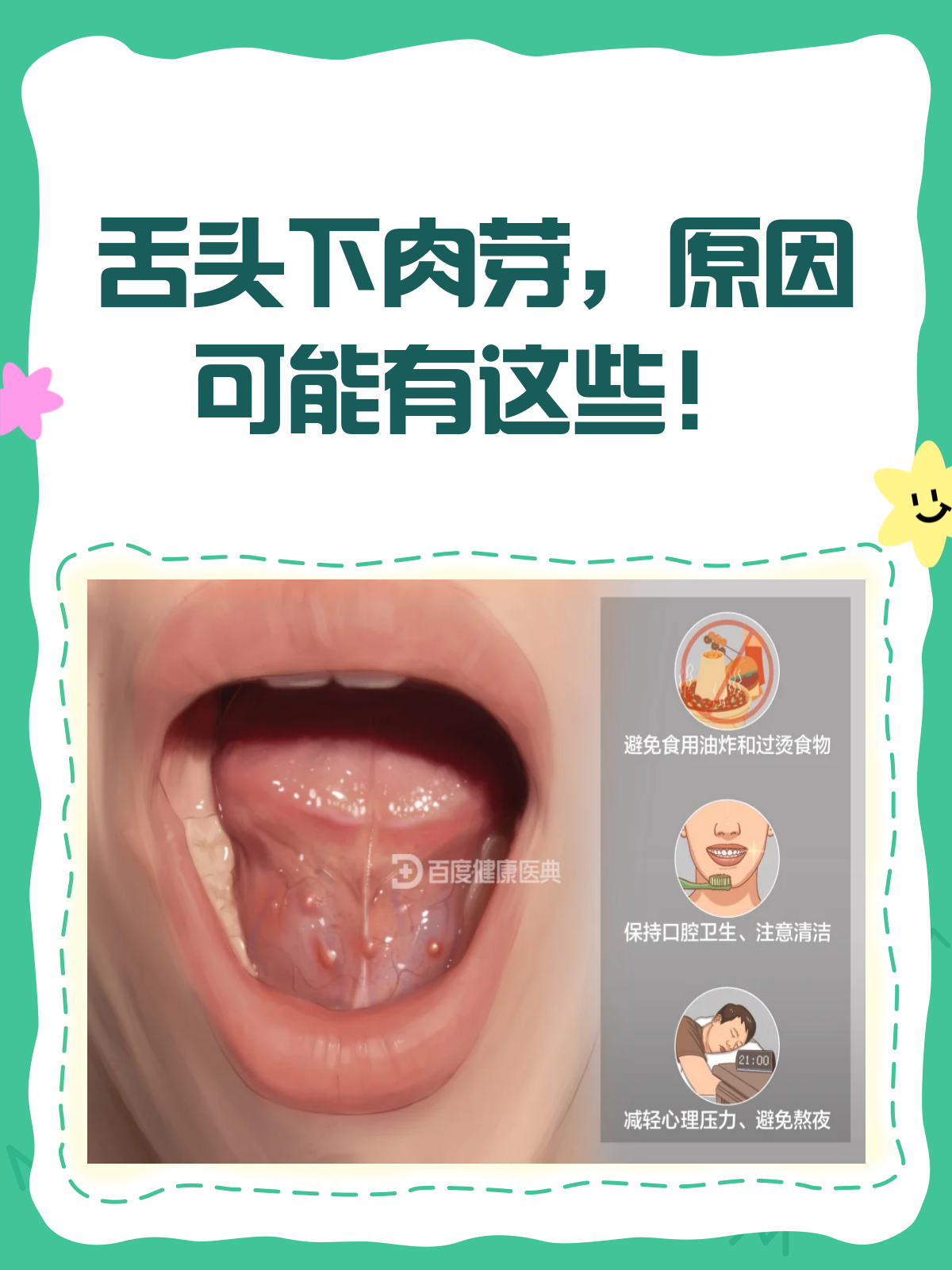 舌头下长小肉芽?别慌,先来看看这个!