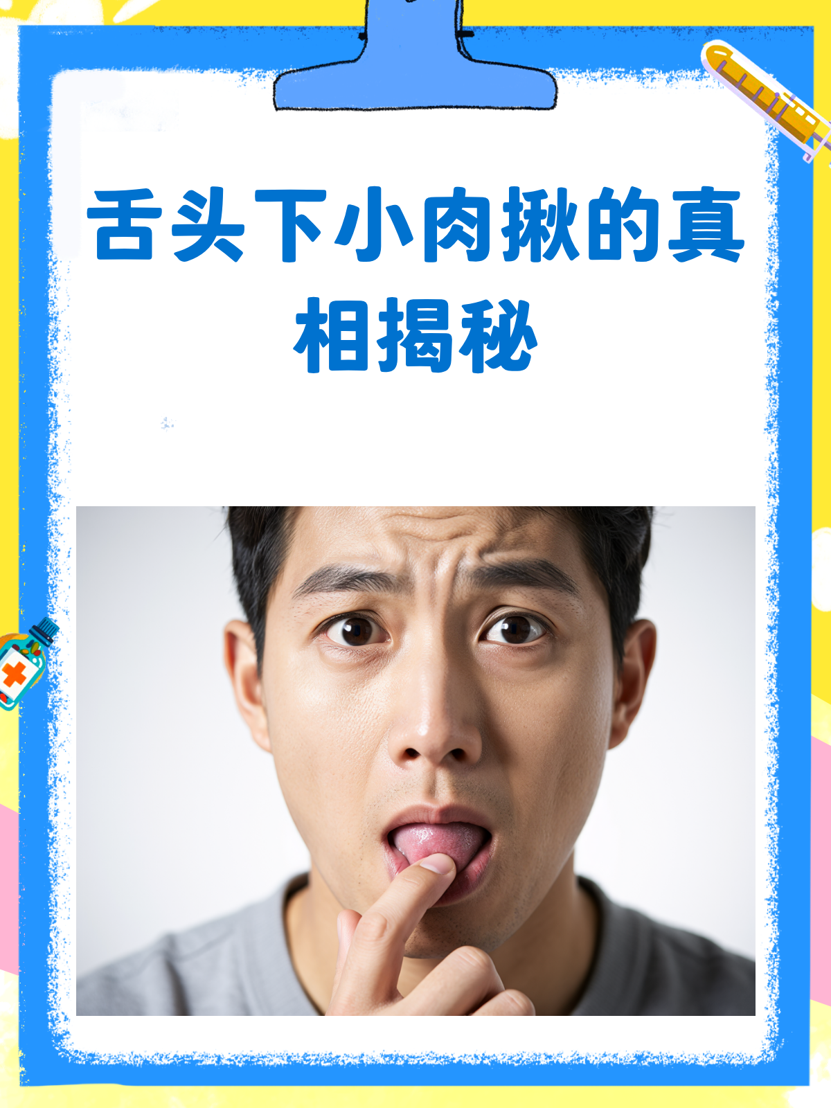舌头下的小肉揪，是病还是正常？