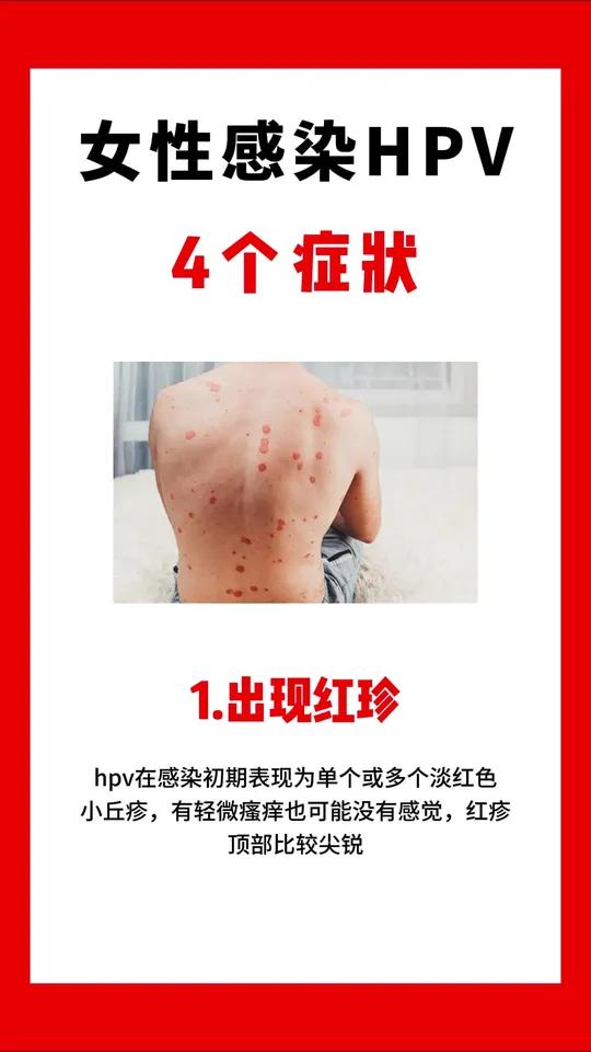女性感染HPV的4个症状