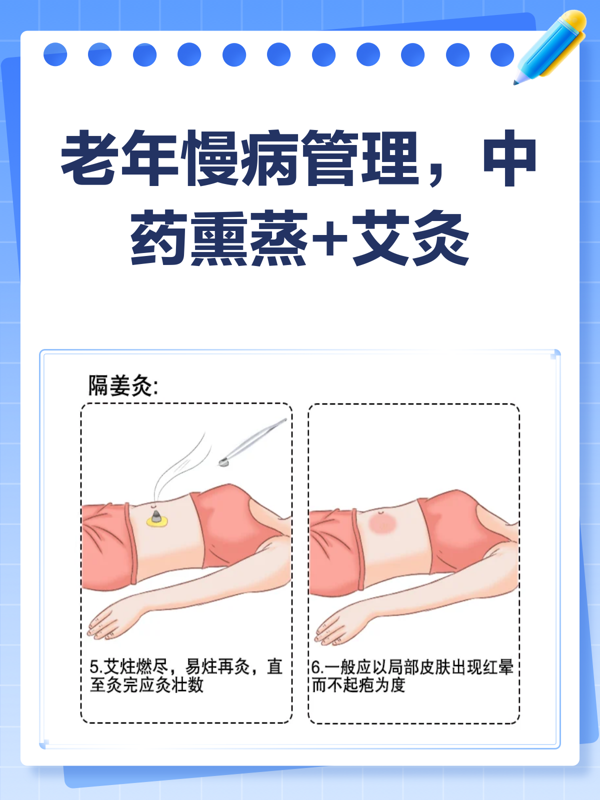 中药熏蒸+艾灸,老年慢病的调理秘籍!