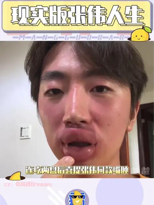 绝命毒师的家,倒霉的他,社死的一生 张伟 过敏 倒霉 社死 搞笑