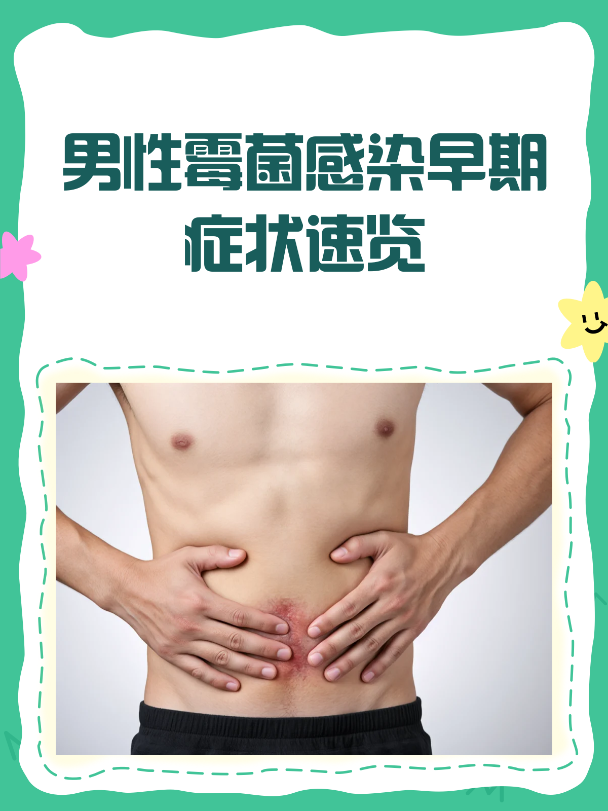 男性霉菌感染,早期症状你中招了吗?