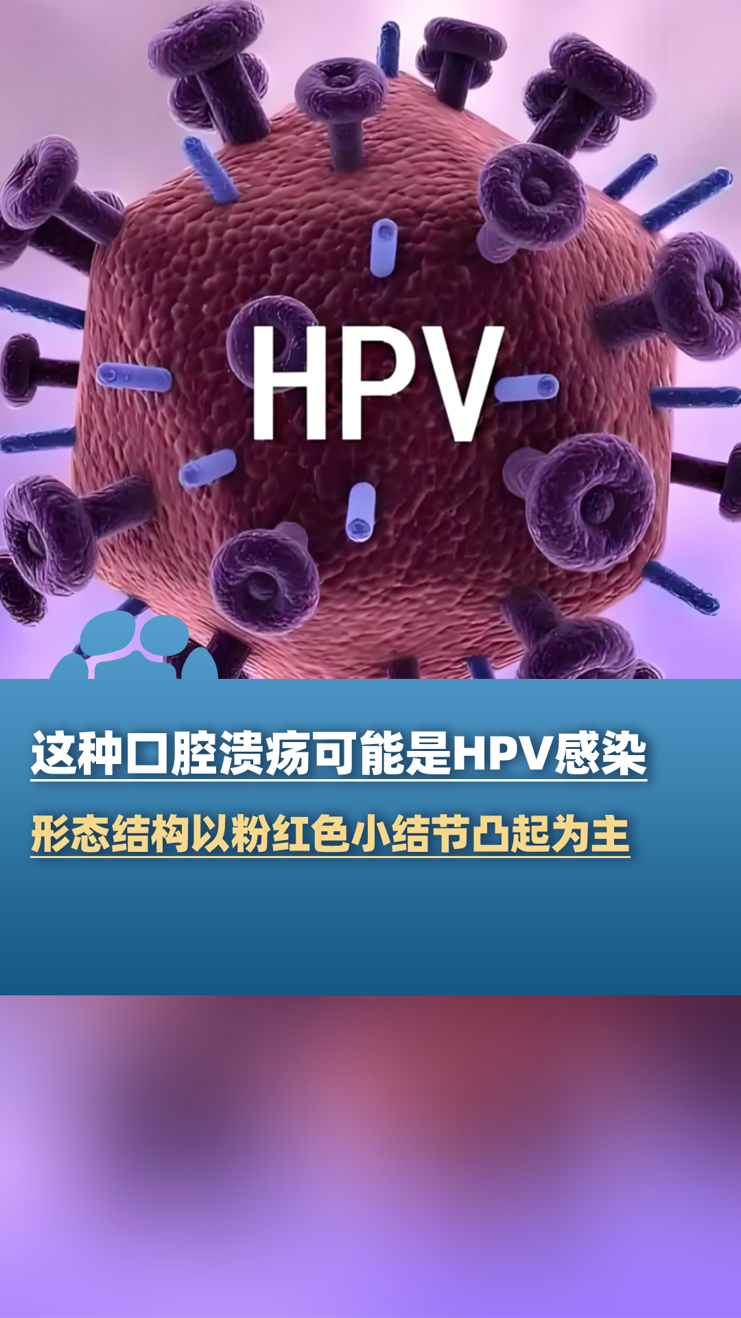 这种口腔溃疡可能是HPV感染,呈菜花样、鸡冠样、乳头状