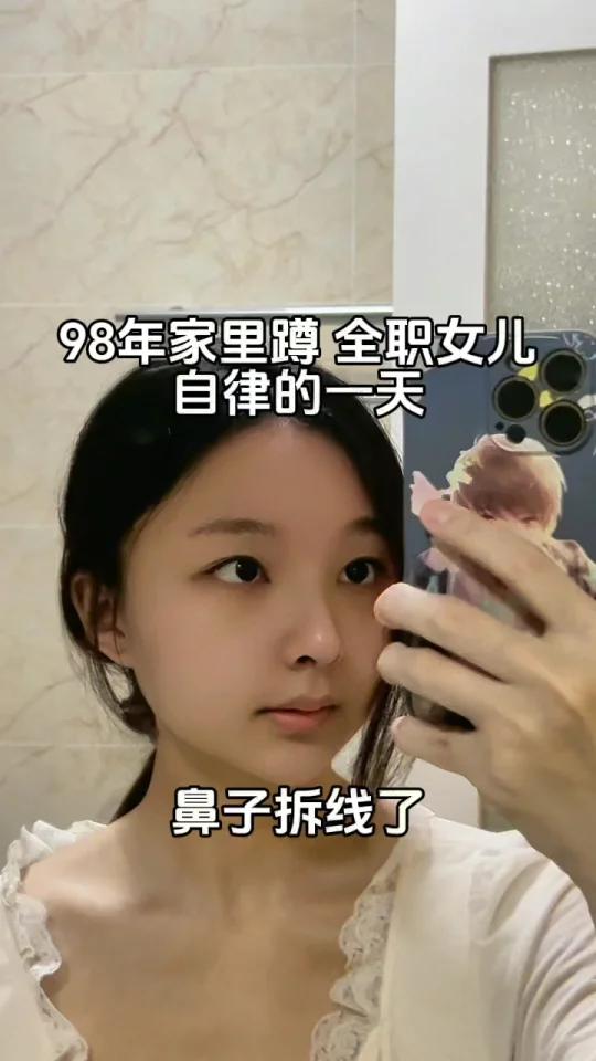 98家里蹲vlog鼻子终于拆线了