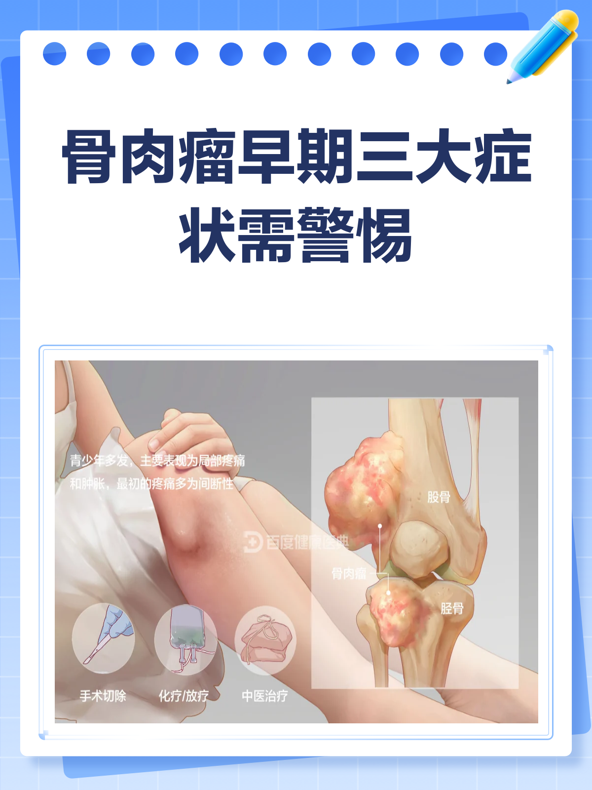 骨肉瘤早期,这些信号你收到了吗?