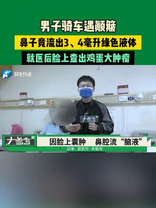 男子骑车遇颠簸,鼻子竟流出3、4毫升绿色液体,就医后脸上查出鸡蛋大肿瘤 常识中国