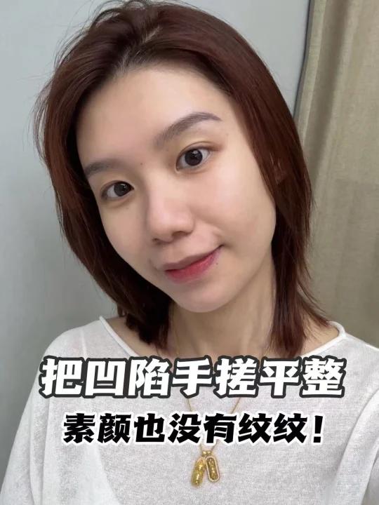 手拿把掐！赫莲娜小针管精准祛纹～