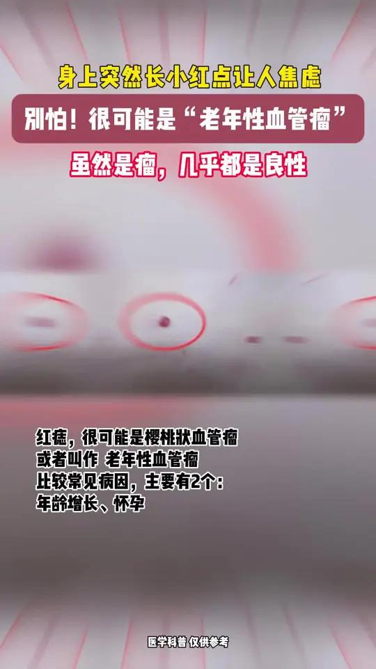 身上突然长小红点 不要害怕可能是以下情况
