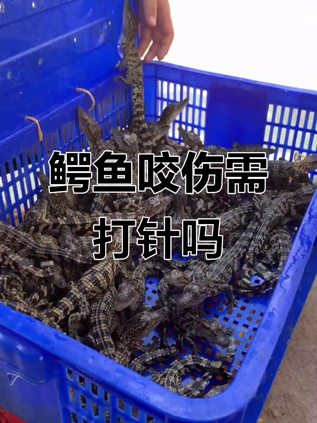 被鳄鱼咬了怎么办？需要打疫苗吗？