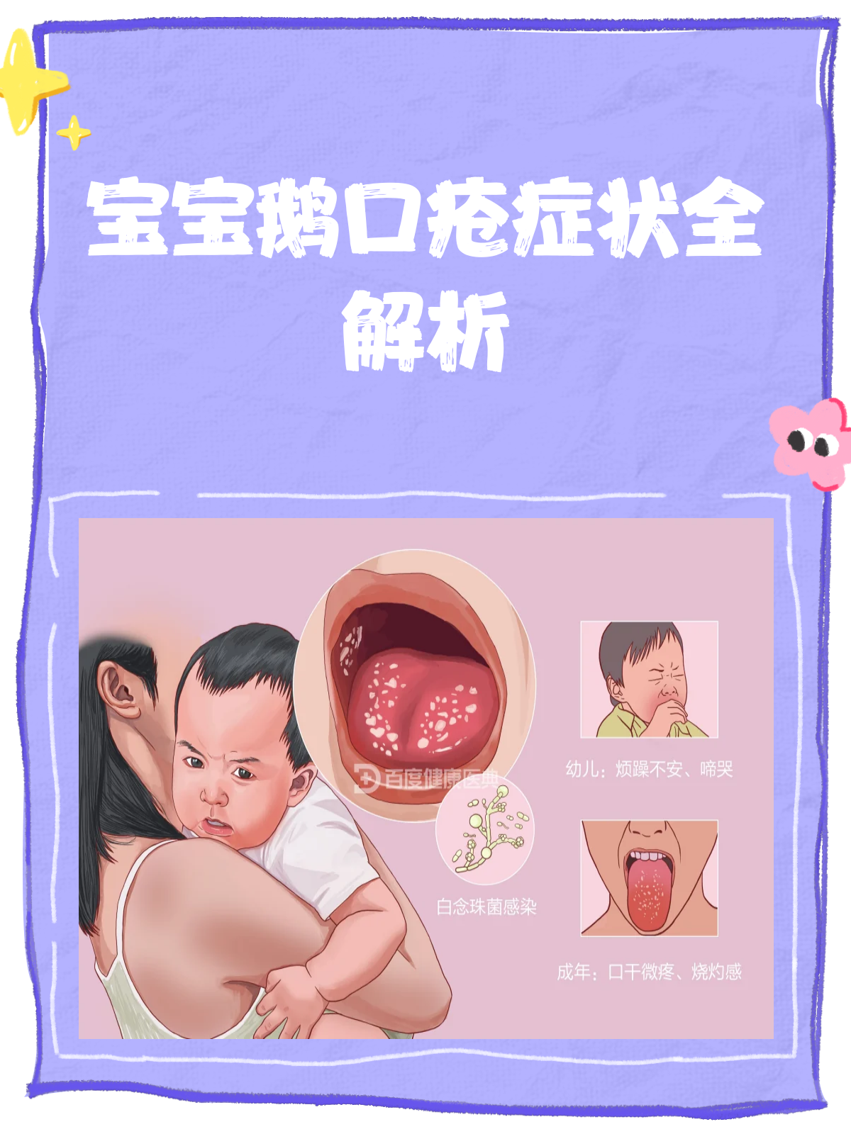 鹅口疮大揭秘!宝宝口腔里的“奶块”是啥?