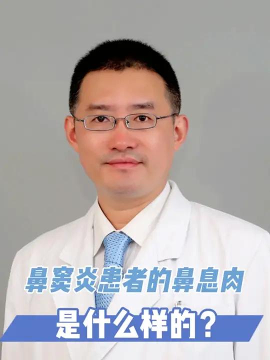 鼻窦炎患者的鼻息肉是什么样?