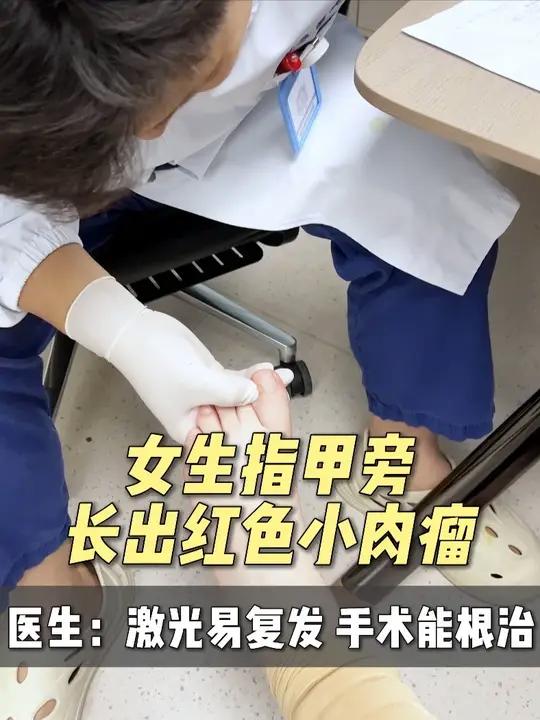 指甲旁边长出一块肉可能不是肉芽，当心是瘤子，趁早治疗 #抖出健康知识宝藏 #华东医院陈亮 