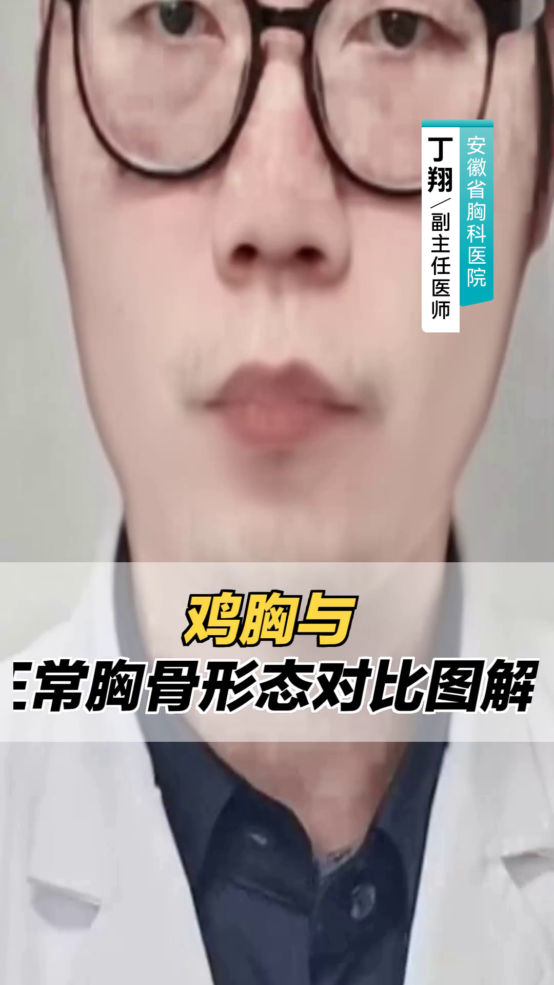 鸡胸与正常胸骨形态对比图解