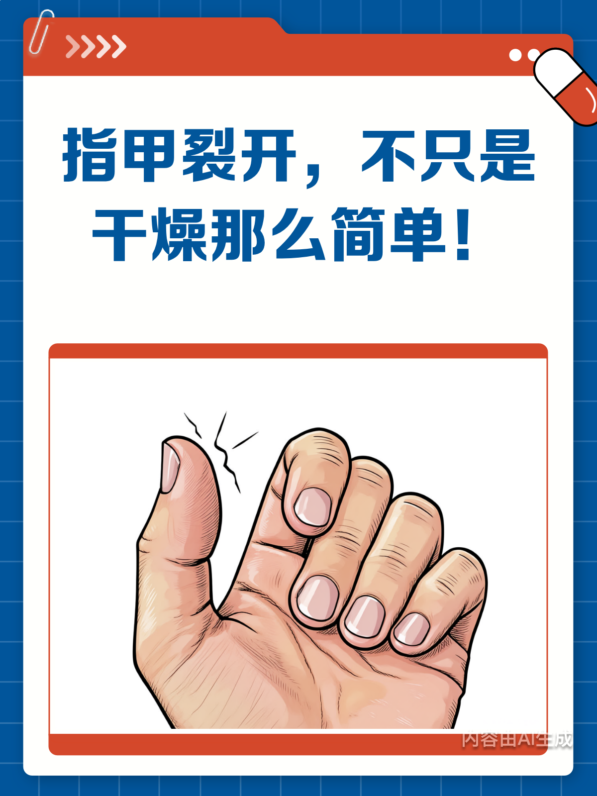指甲裂开，只是因为干燥吗？
