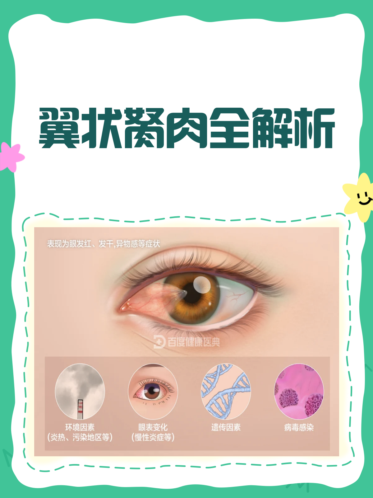 翼状胬肉来袭?了解它,才能战胜它!