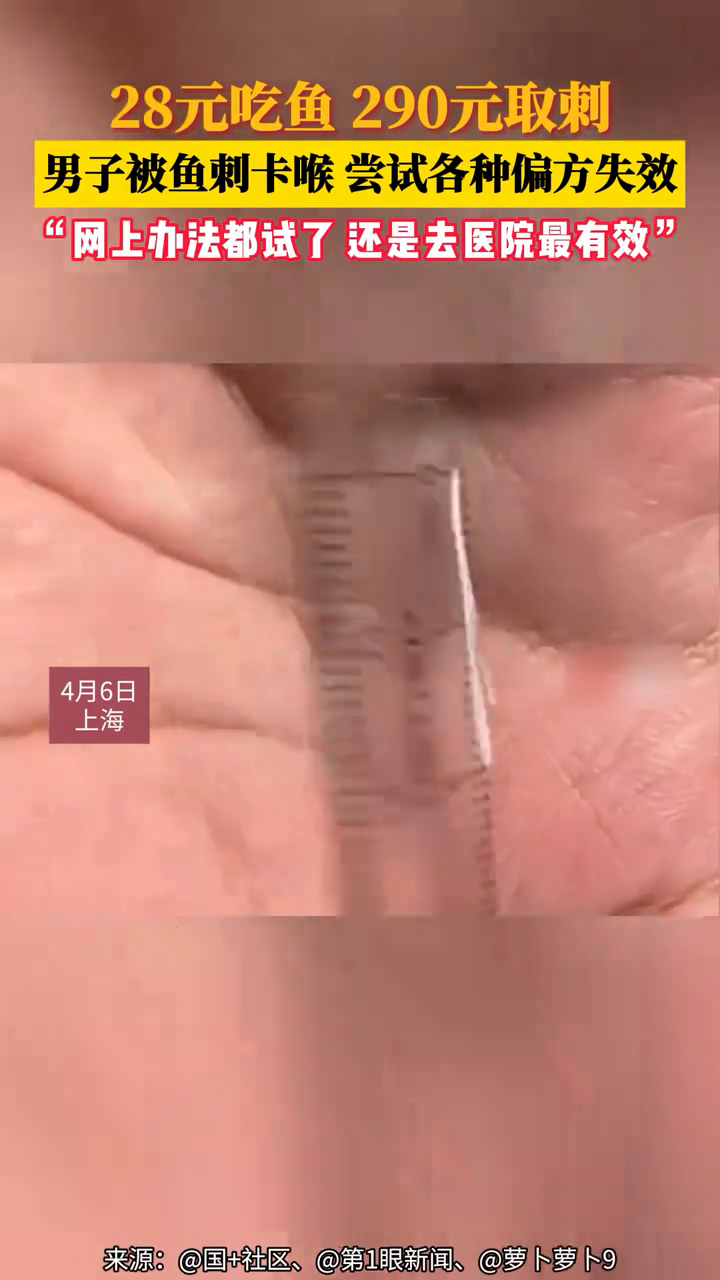 28元吃鱼 290元取刺,男子被鱼刺卡喉 尝试各种偏方失效