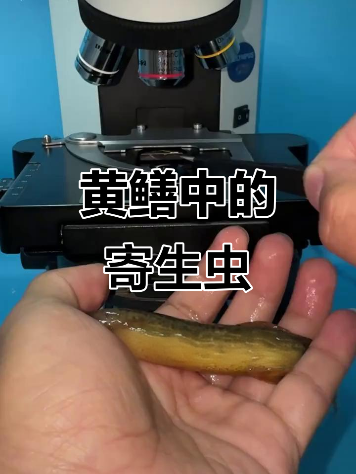 黄鳝显微镜下惊现寄生虫,高温煮熟才安全