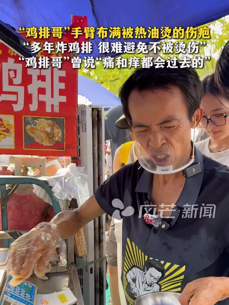 “鸡排哥”手臂布满被热油烫的伤疤:多年炸鸡排很难避免不被烫伤