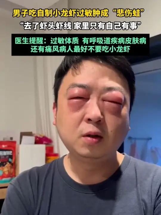 5月4日(采访日期)江苏常熟,男子吃自制小龙虾过敏肿成“悲伤蛙”“去了虾头虾线 家里只有自