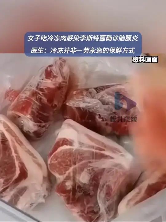 55岁女子吃冷冻肉感染脑膜炎 近日,河南驻马店。55岁的李女士说前些天她感觉头疼得厉害,“